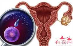 知名的试管婴儿助孕总费用 香港助孕：为什么生殖医生要求月经第三天做B超检